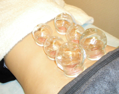 �z���ʗÖ@�i�J�b�s���O�j